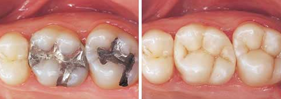 Brush Your Teeth
